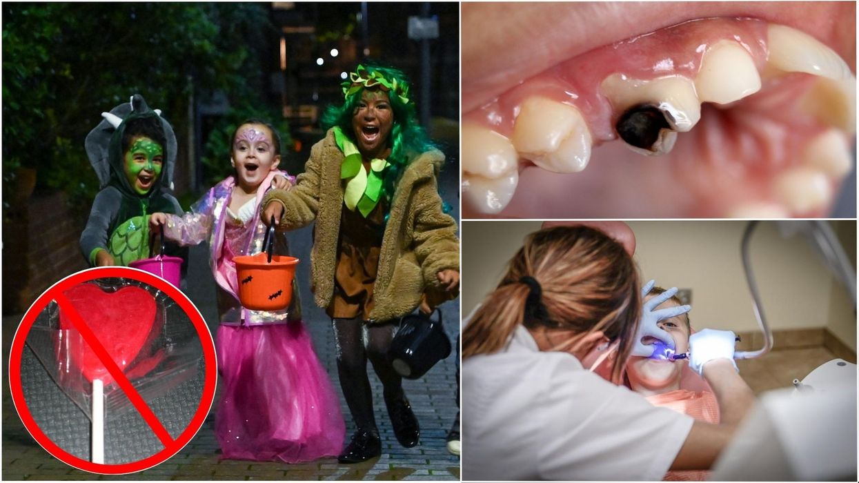 Kids Trick or treating, Rotten tooth, Dentist, Lollipop