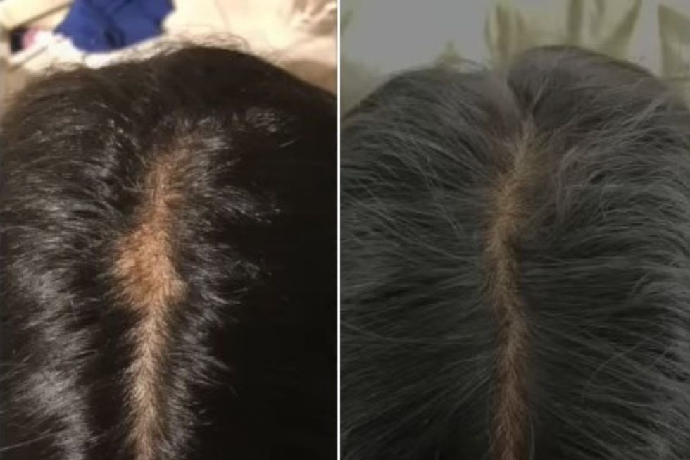 kiki before and after