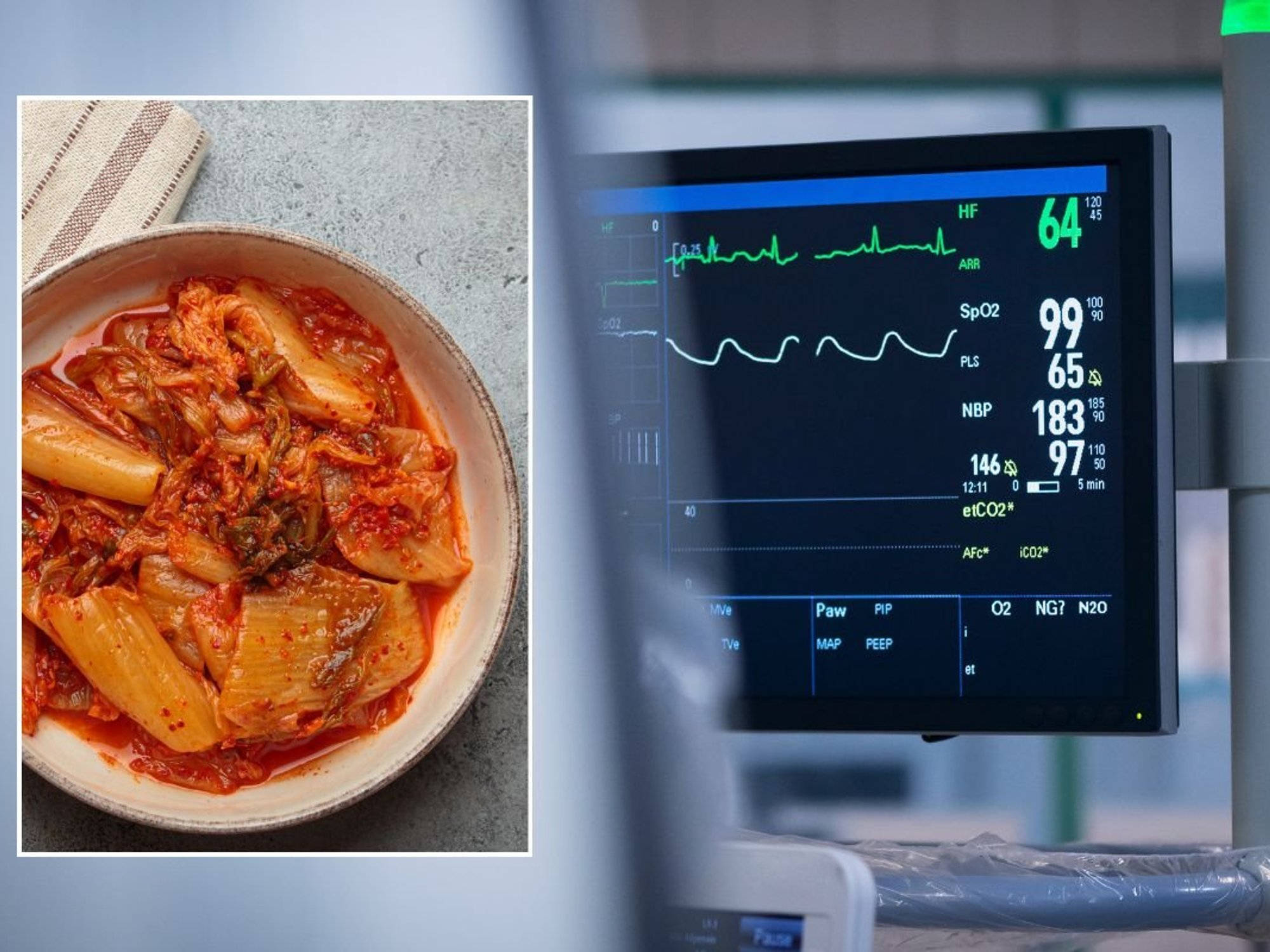 KIMCHI / ELECTROCARDIOGRAM