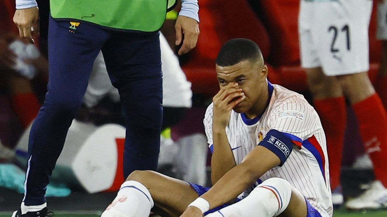 Kylian Mbappe suffered a broken nose against Austria