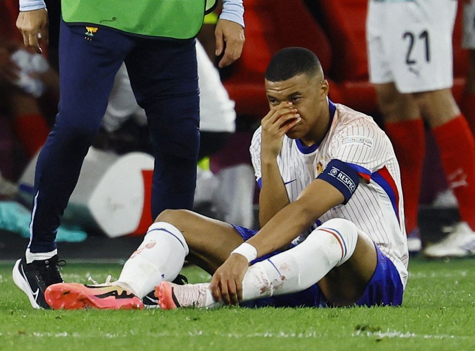 Kylian Mbappe suffered a broken nose against Austria