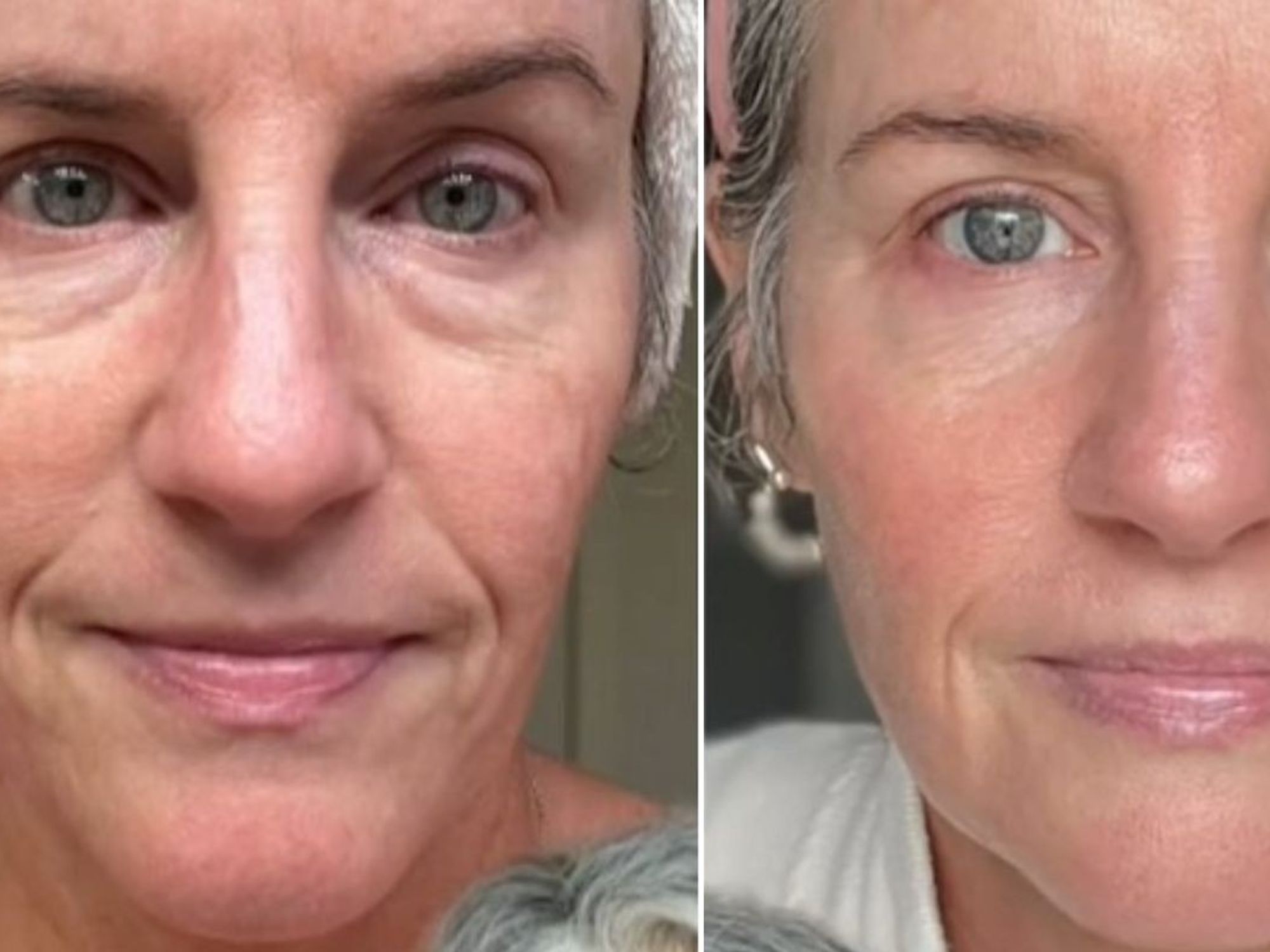 Laura before and after