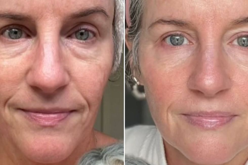 Laura before and after