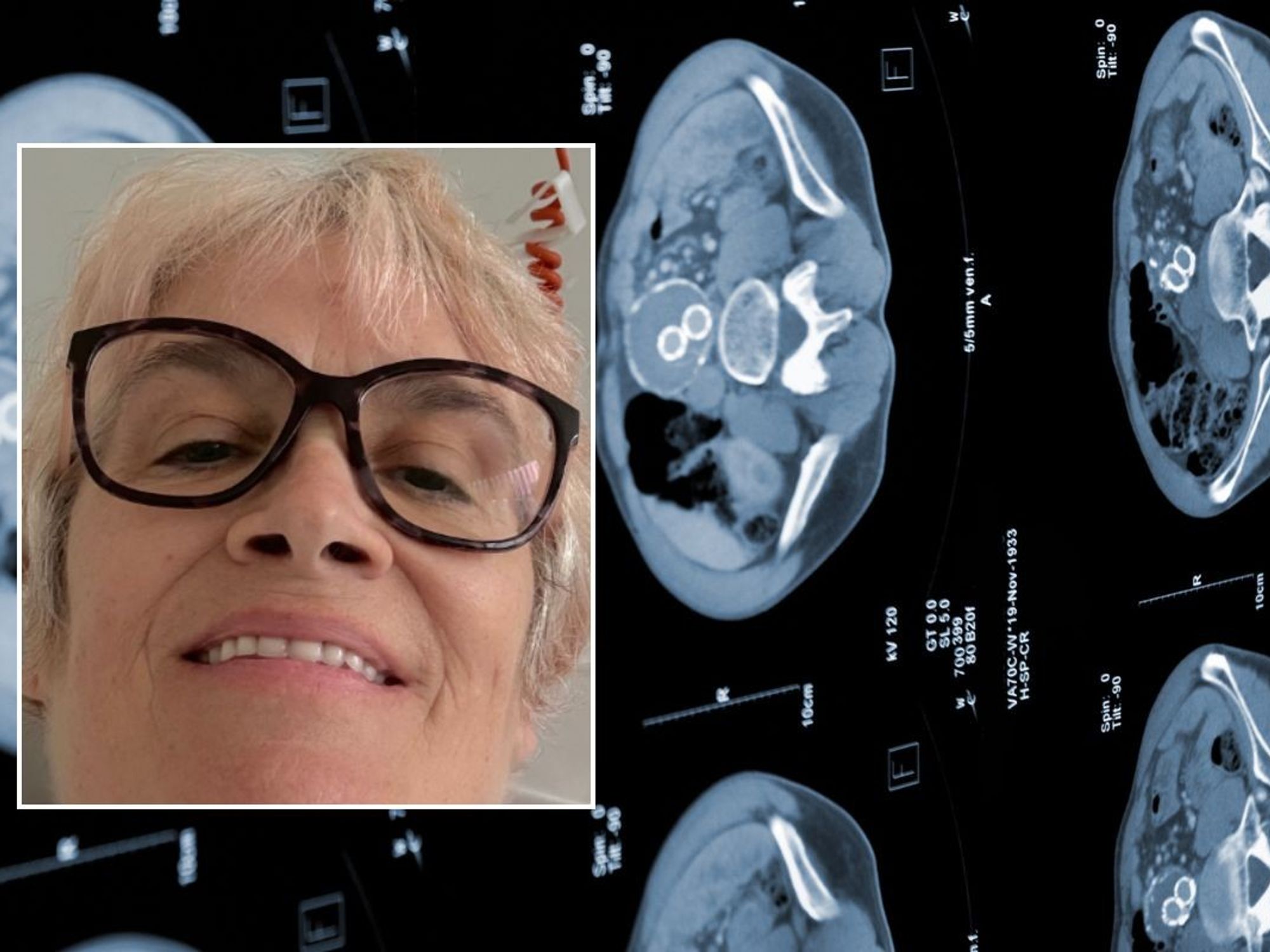 LAURA HEADSHOT AND ABDOMINAL SCAN