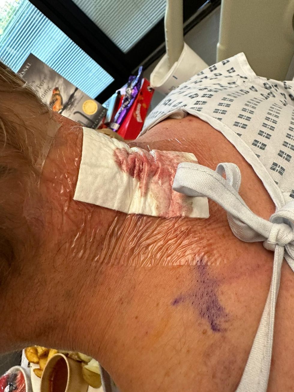 Laurence Fox operation