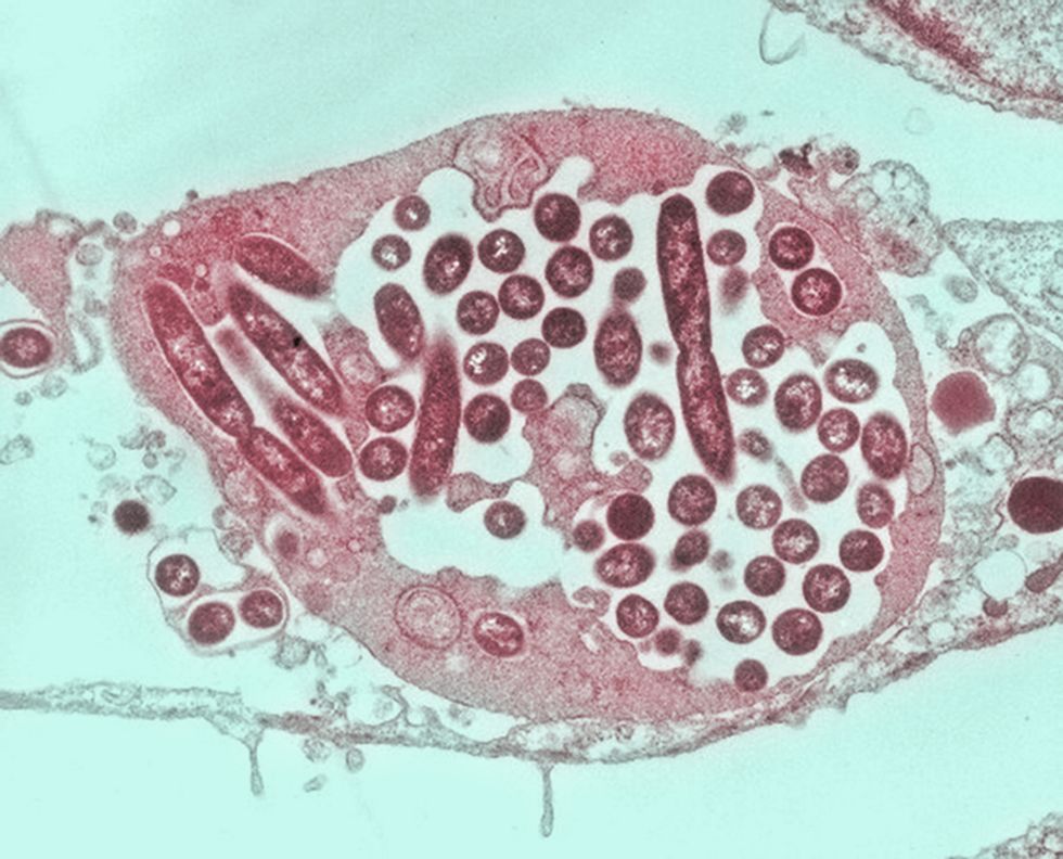 Legionnaire's under microscope