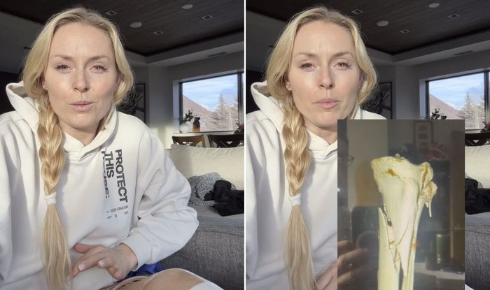 Lindsey Vonn has thanked her doctor for "saving her life" after nearly losing her leg