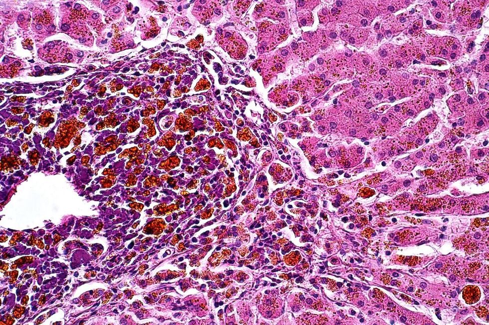 LIVER TISSUE UNDER MICROSCOPE