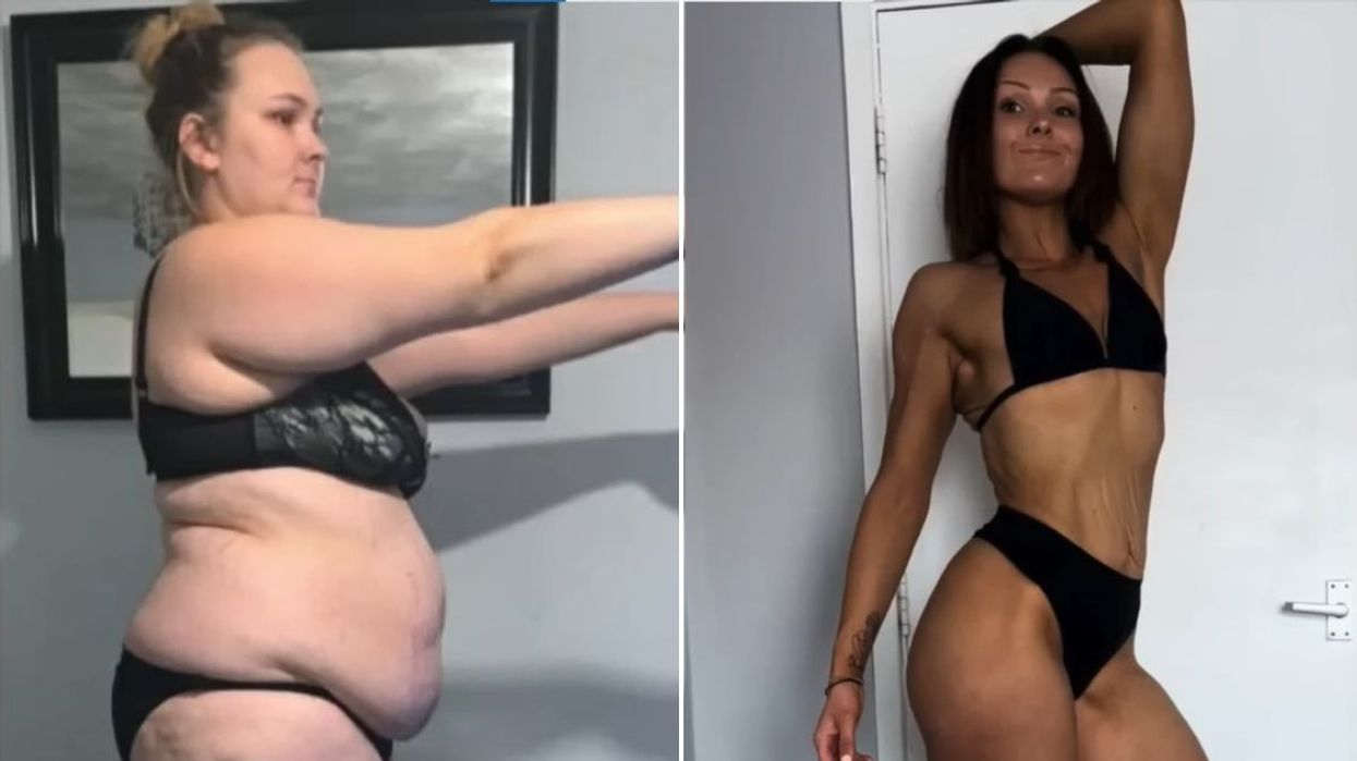 LOUISE BEFORE AND AFTER