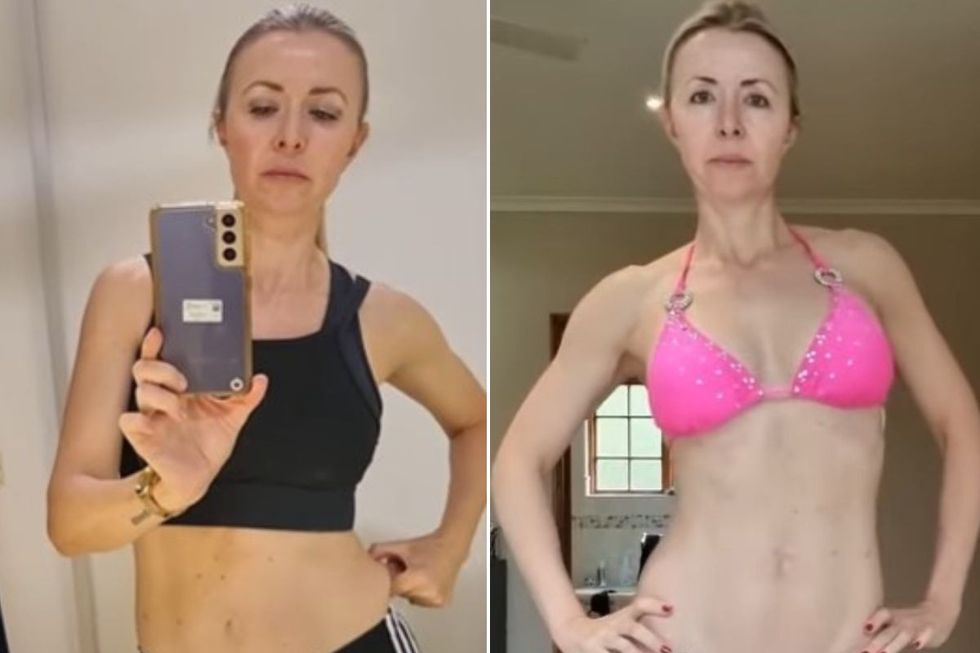 louise before and after