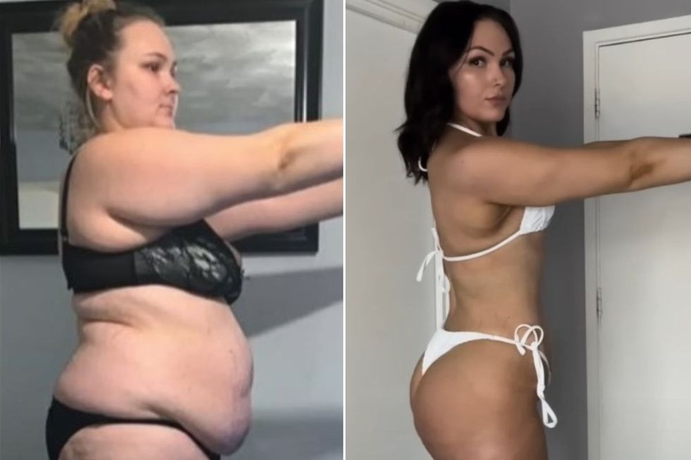 LOUISE BEFORE AND AFTER