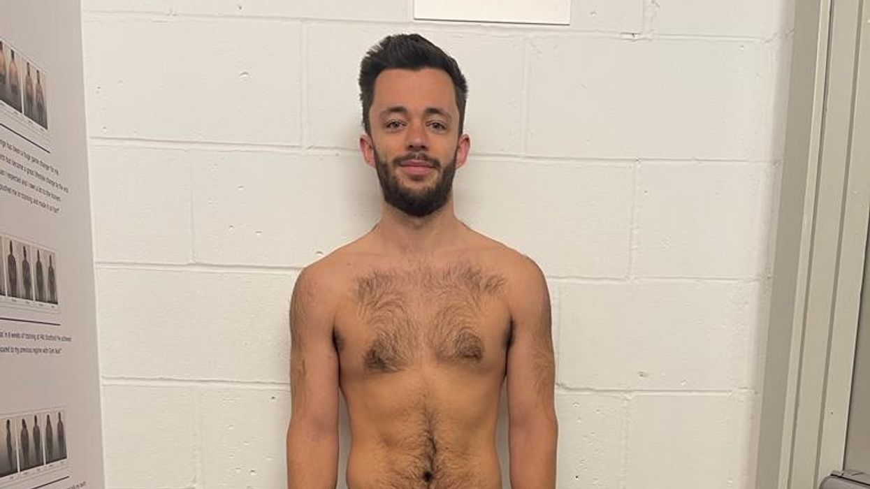 Man after weight loss transformation