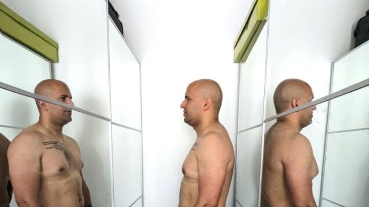 Man after weight loss