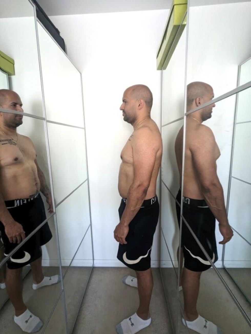 Man after weight loss
