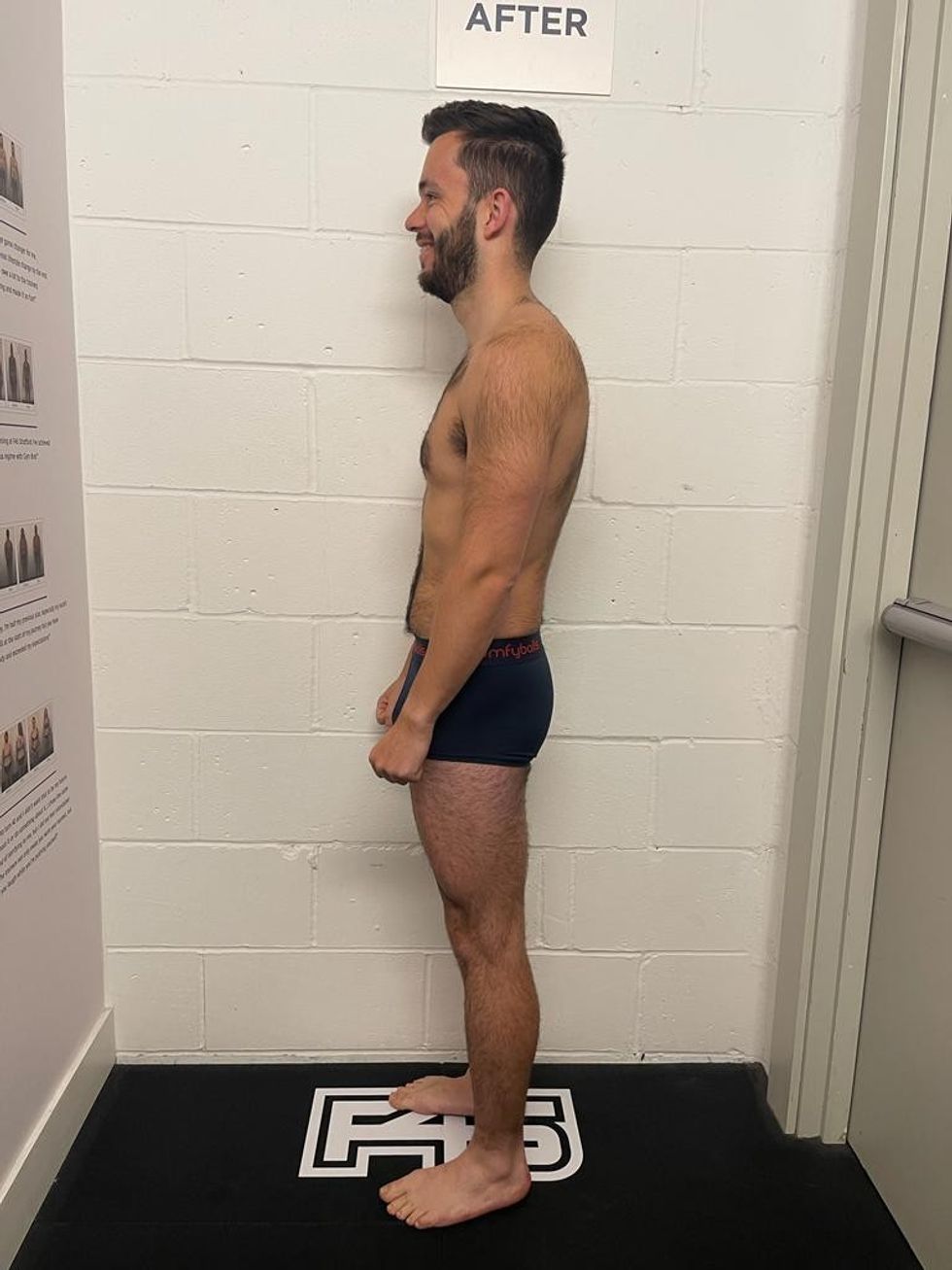 Man after weight loss