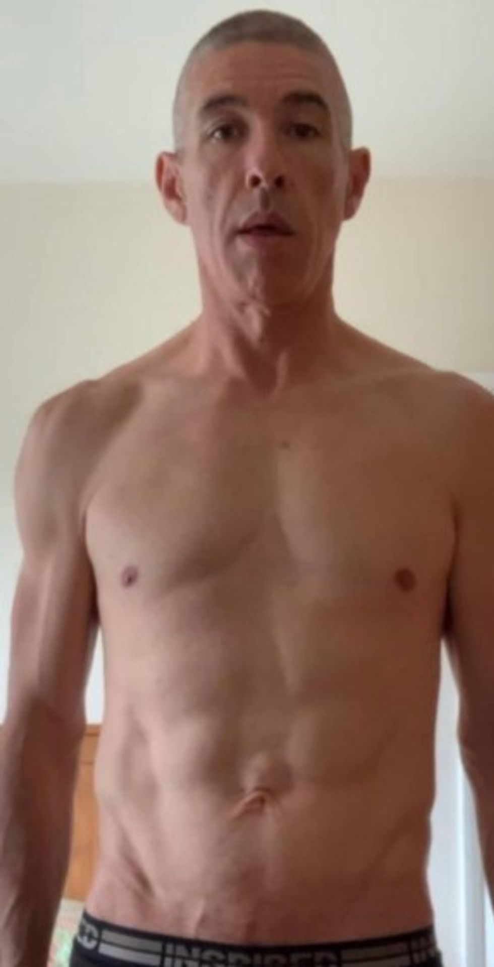 Man after weight loss