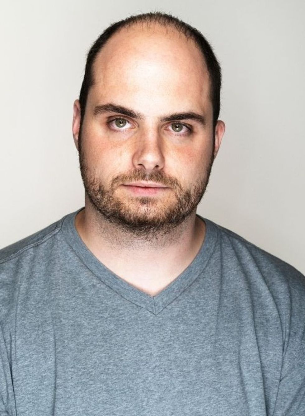 Man balding