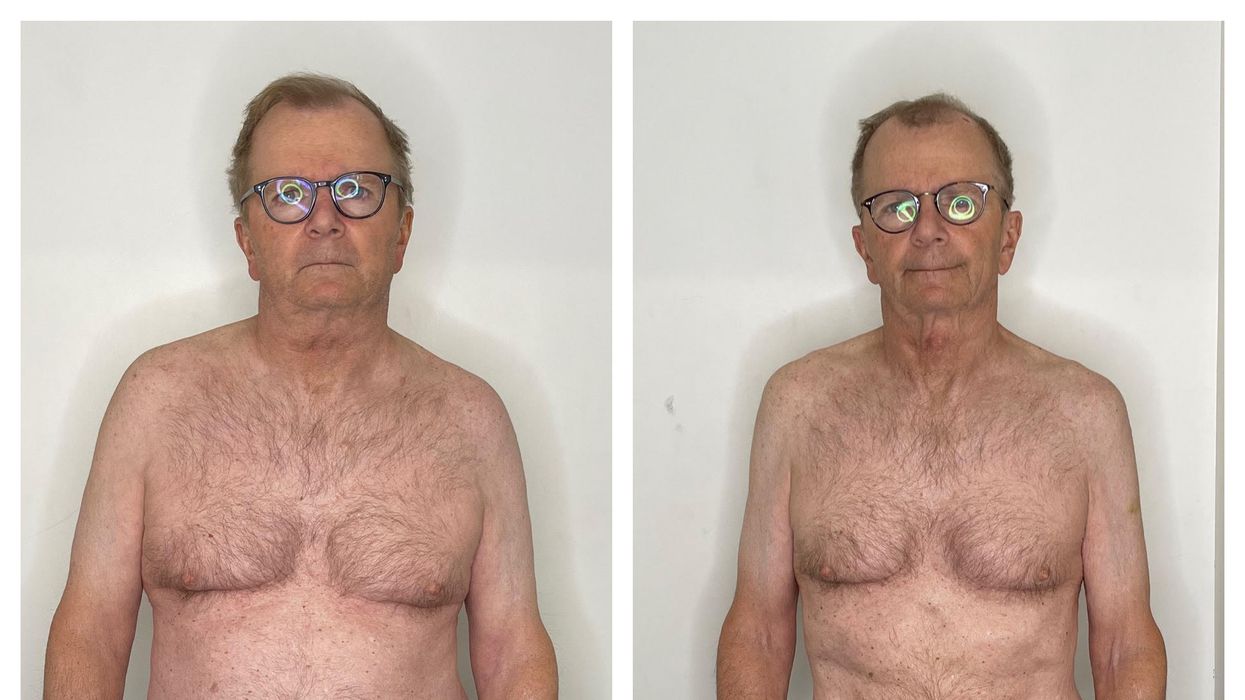 Man before after weight loss