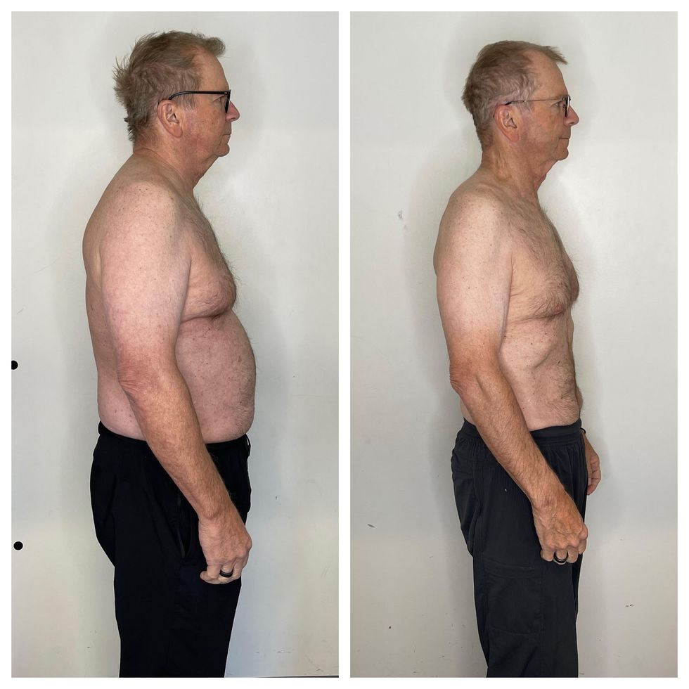 Man before after weight loss