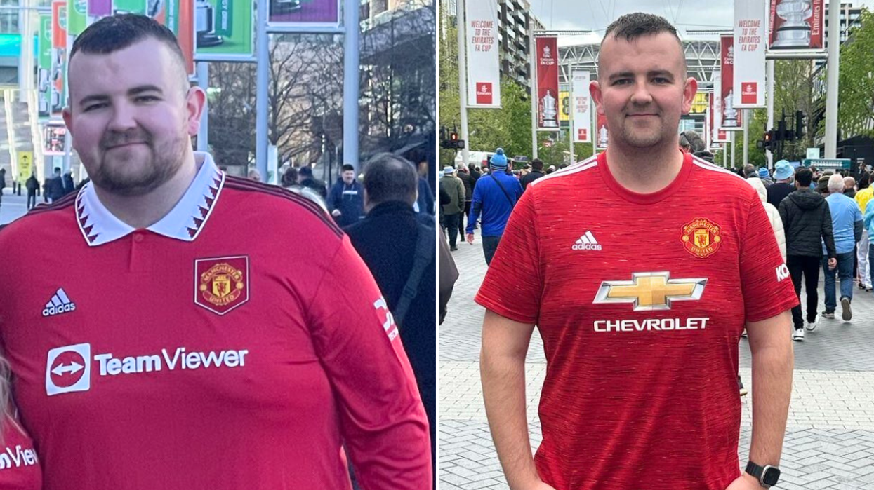 Man before / after weight loss