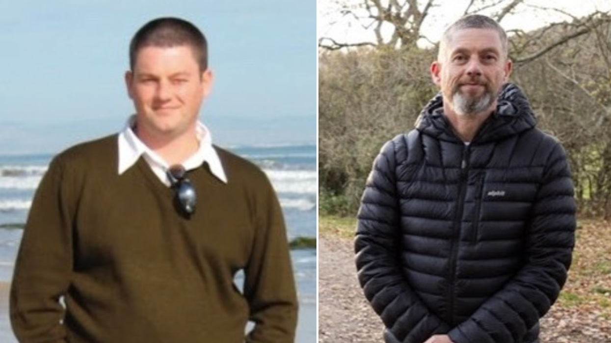 Man before and after weight loss