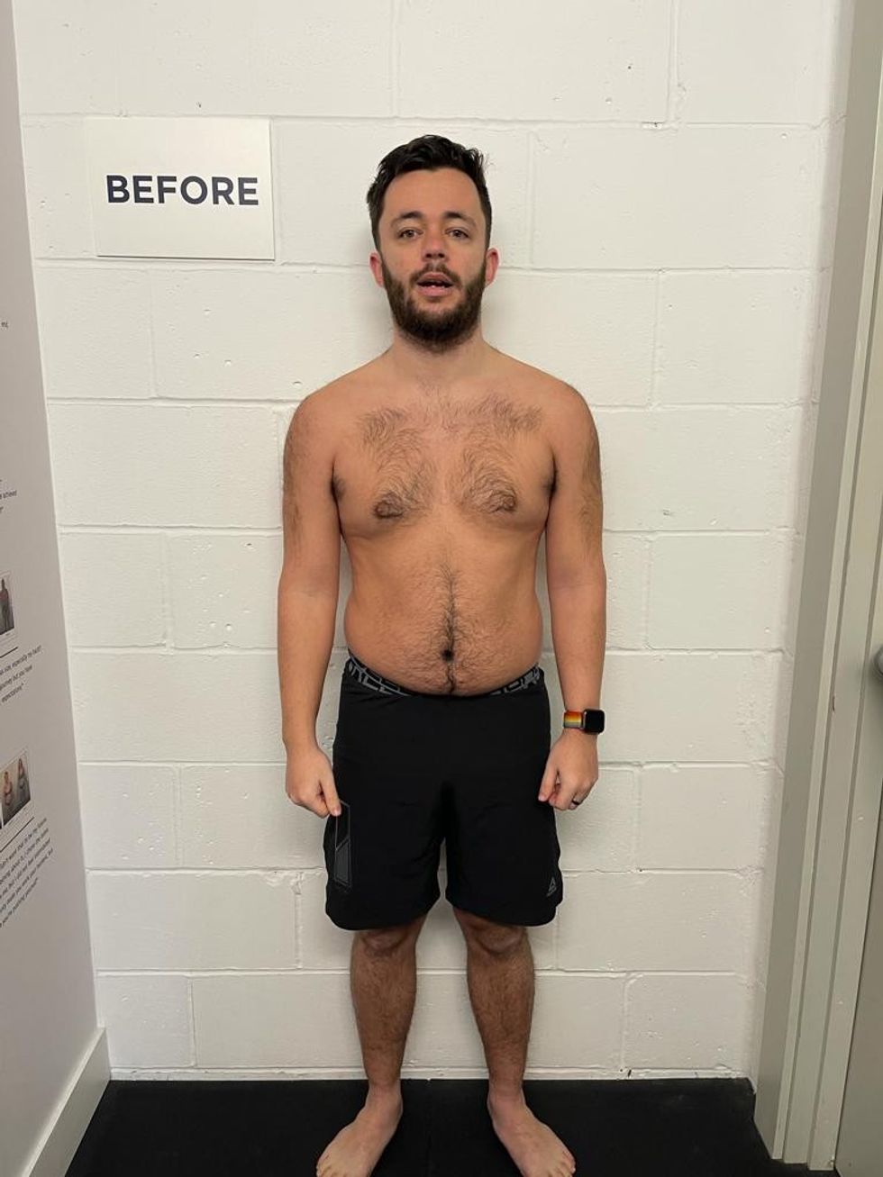 Man before weight loss transformation