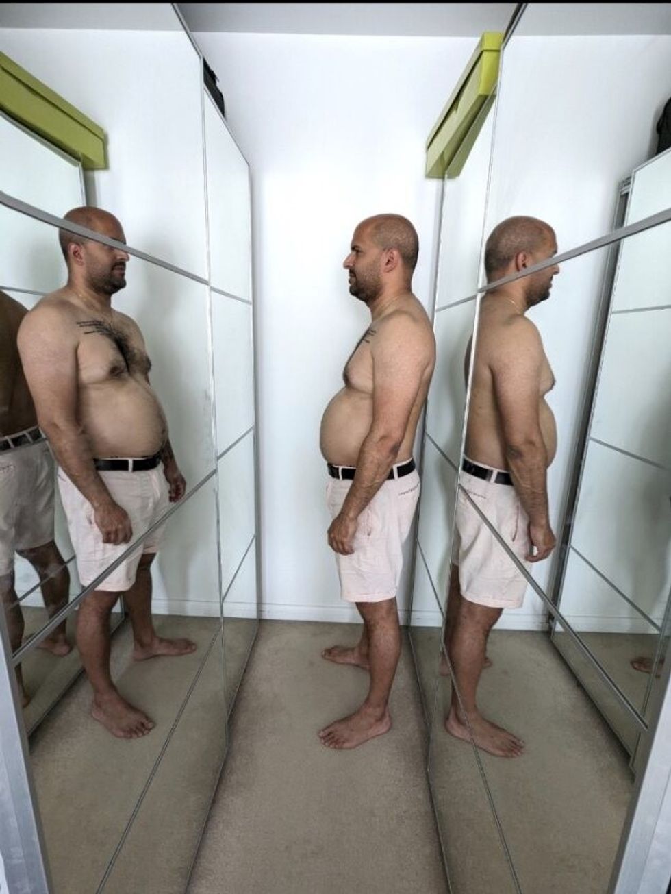 Man before weight loss