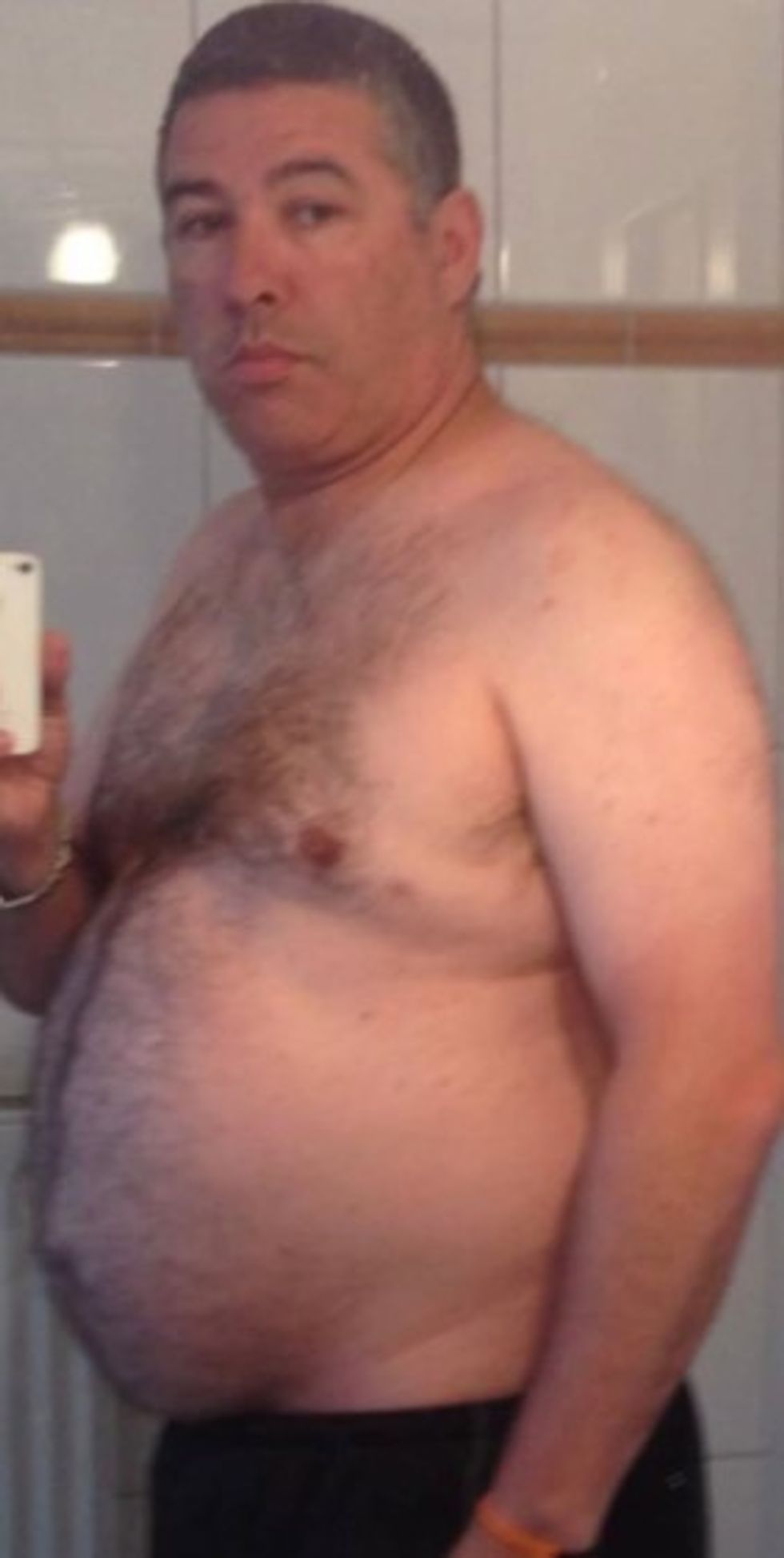 Man before weight loss