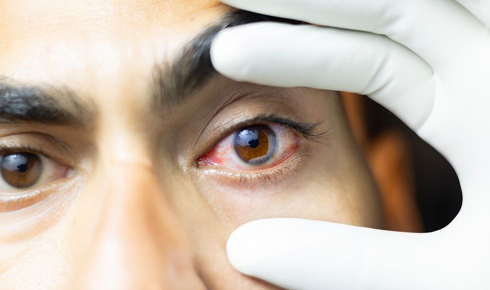 Man getting his eye examined
