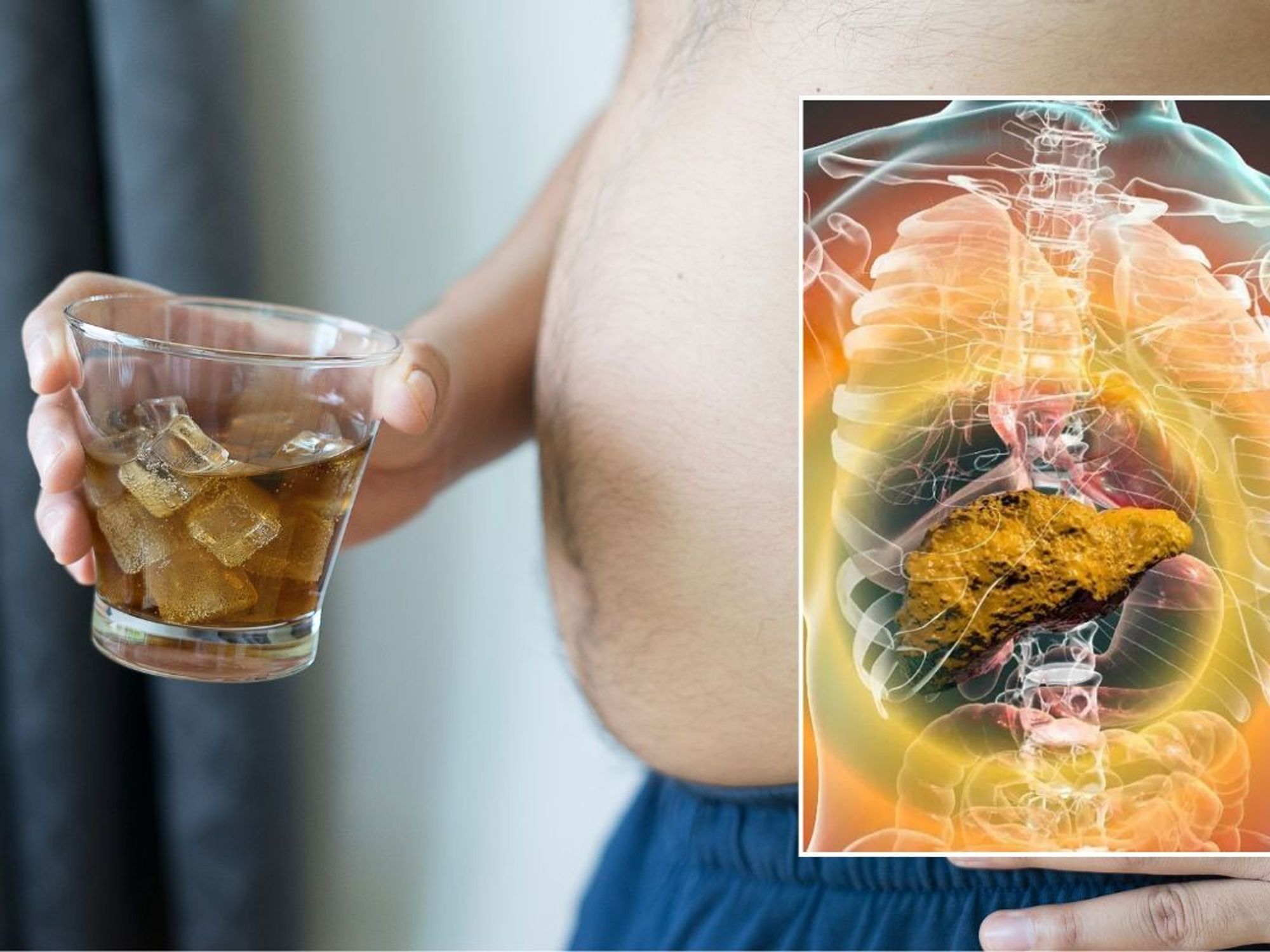 man holding soft drink and fatty liver composite