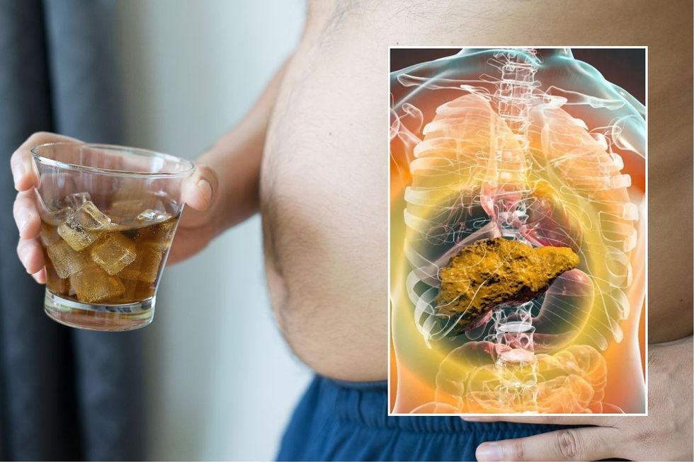 man holding soft drink and fatty liver composite