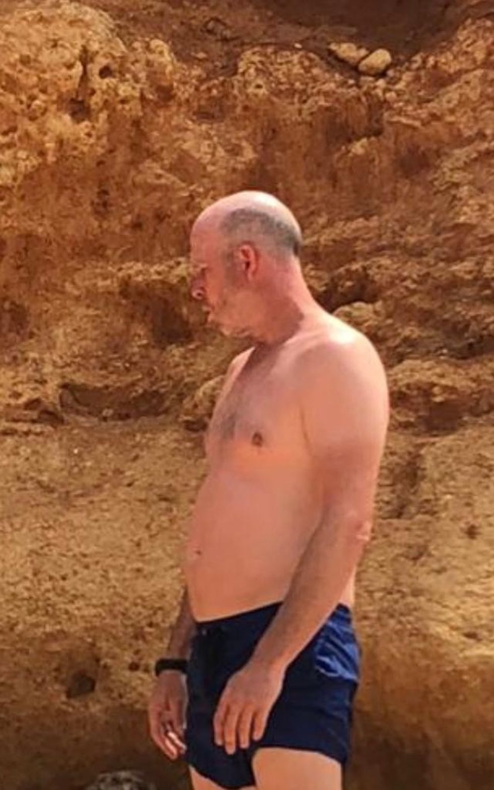 Man in trunks before weight loss