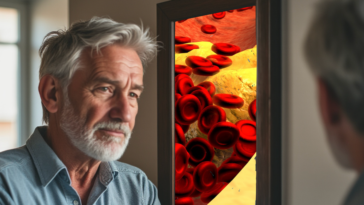 Man looking in the mirror next to cholesterol deposits