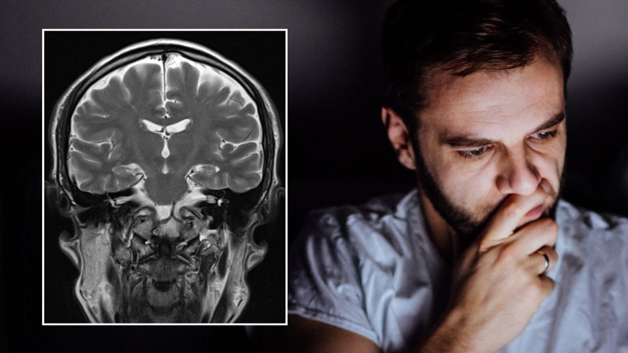 MAN ON COMPUTER AND BRAIN SCAN