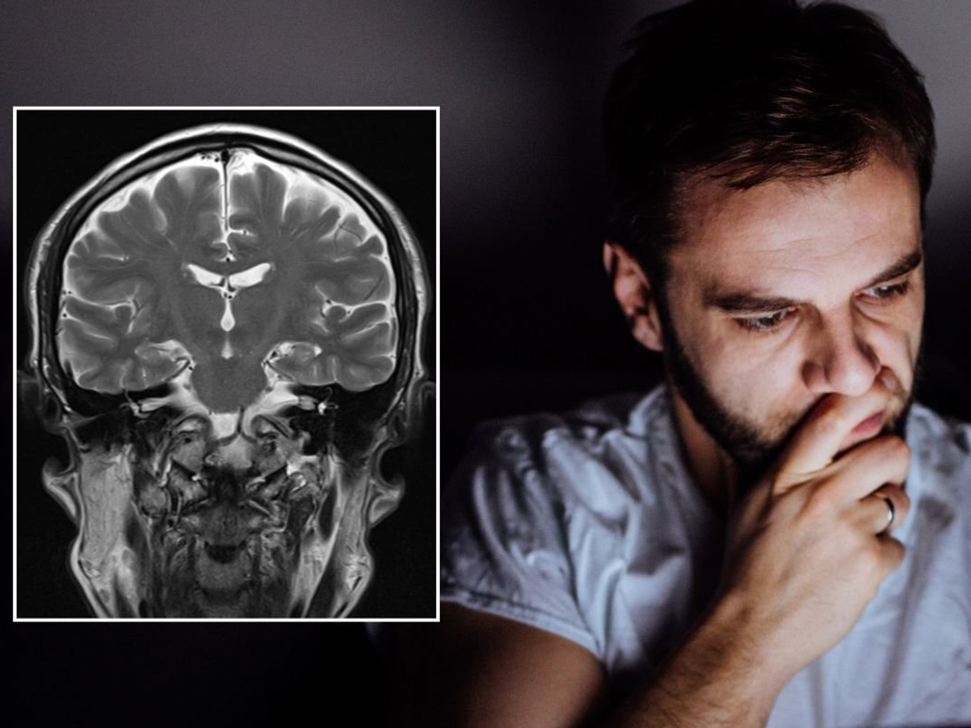 MAN ON COMPUTER AND BRAIN SCAN