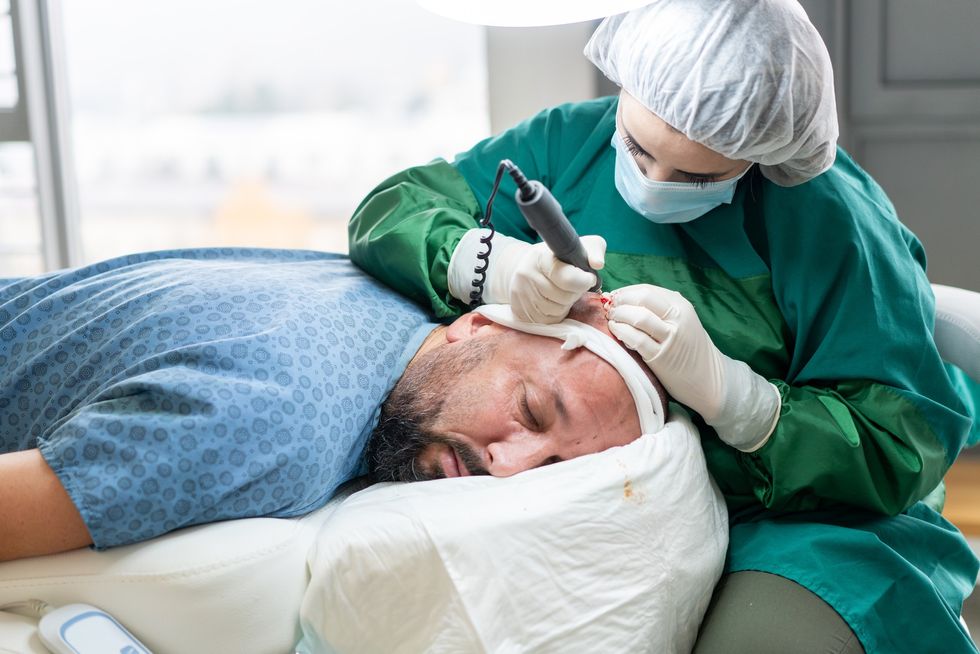 Man undergoing hair transplant