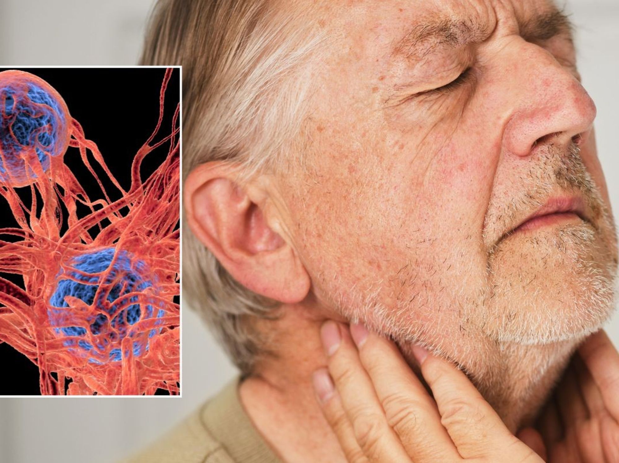 MAN WITH SORE THROAT AND TUMOUR