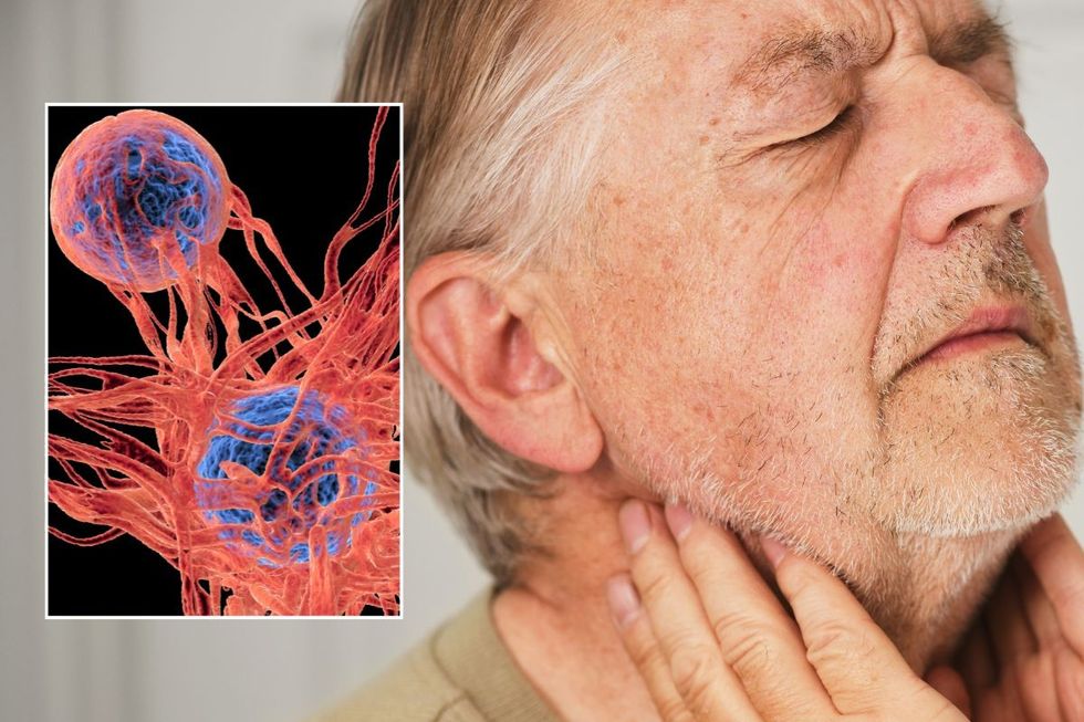 MAN WITH SORE THROAT AND TUMOUR