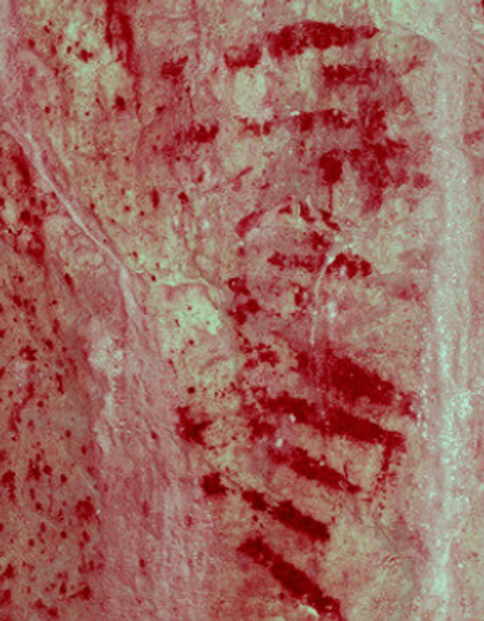 Markings