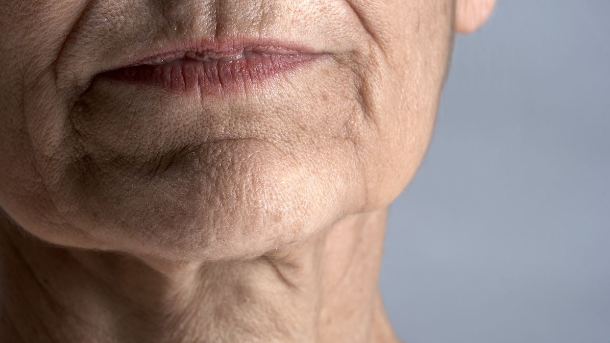 MATURE WOMAN JOWLS