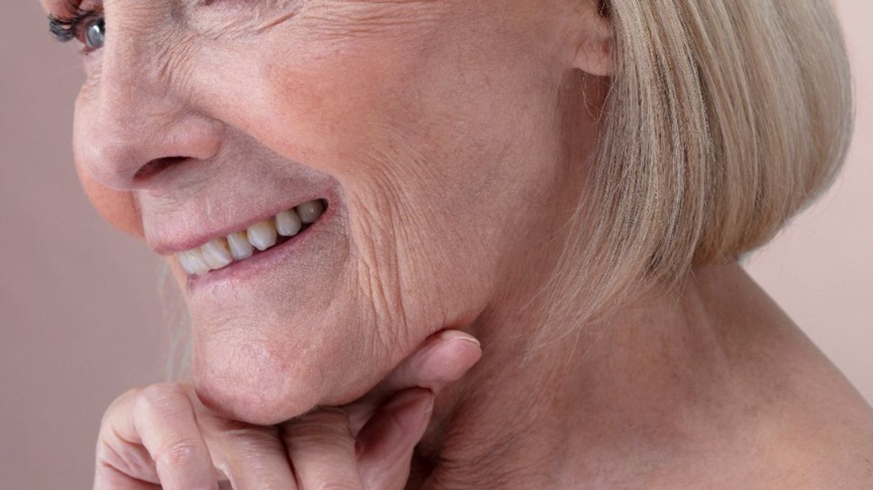 Mature woman with jowls