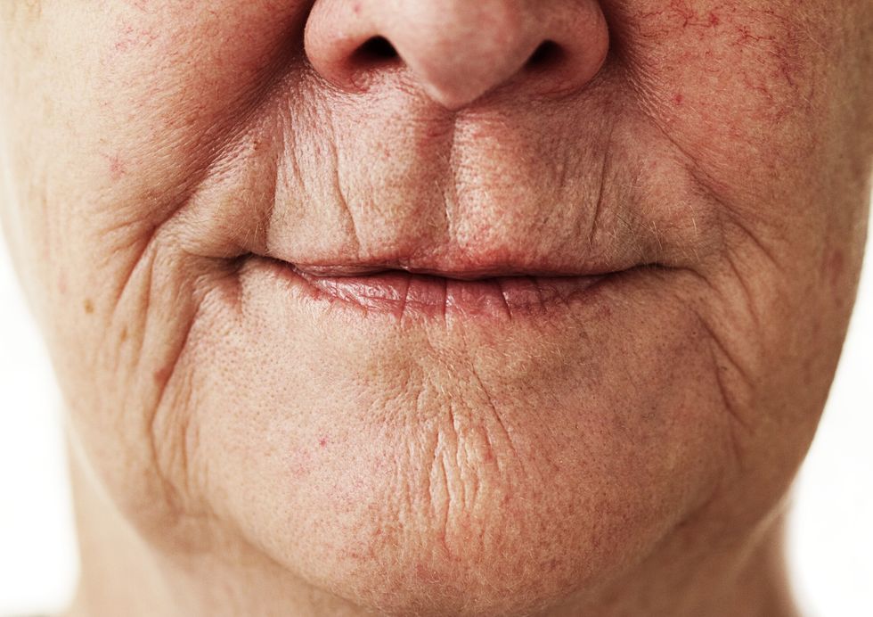Mature woman with lip lines