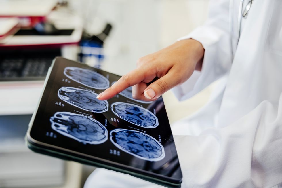 Medic in white coat studies brain scans on an iPad