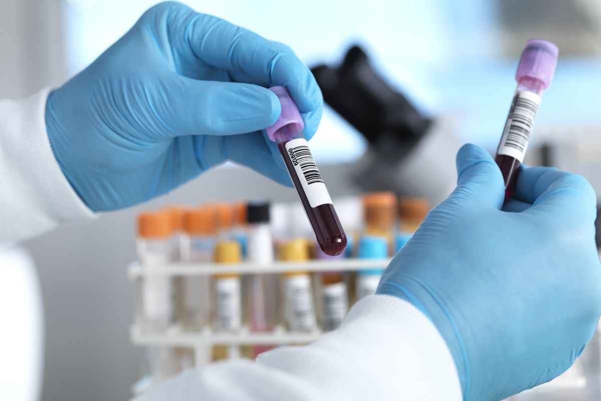 Medical expert handling a blood test vial 