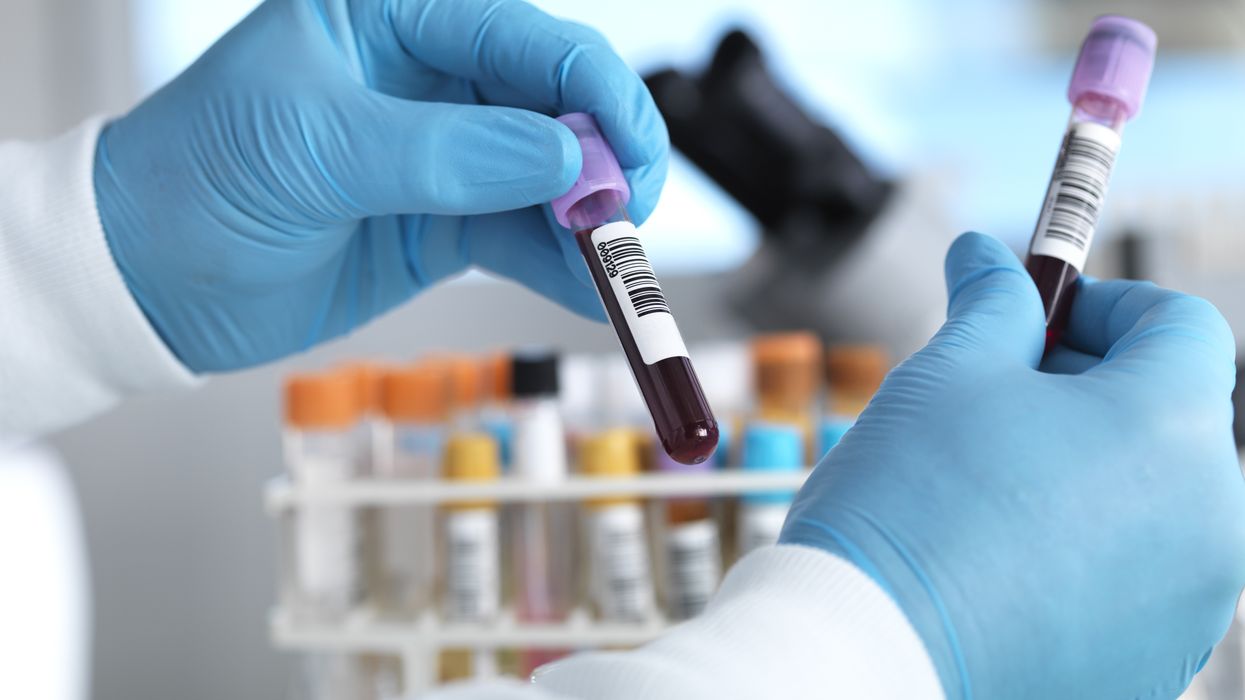 Medical expert handling a blood test vial