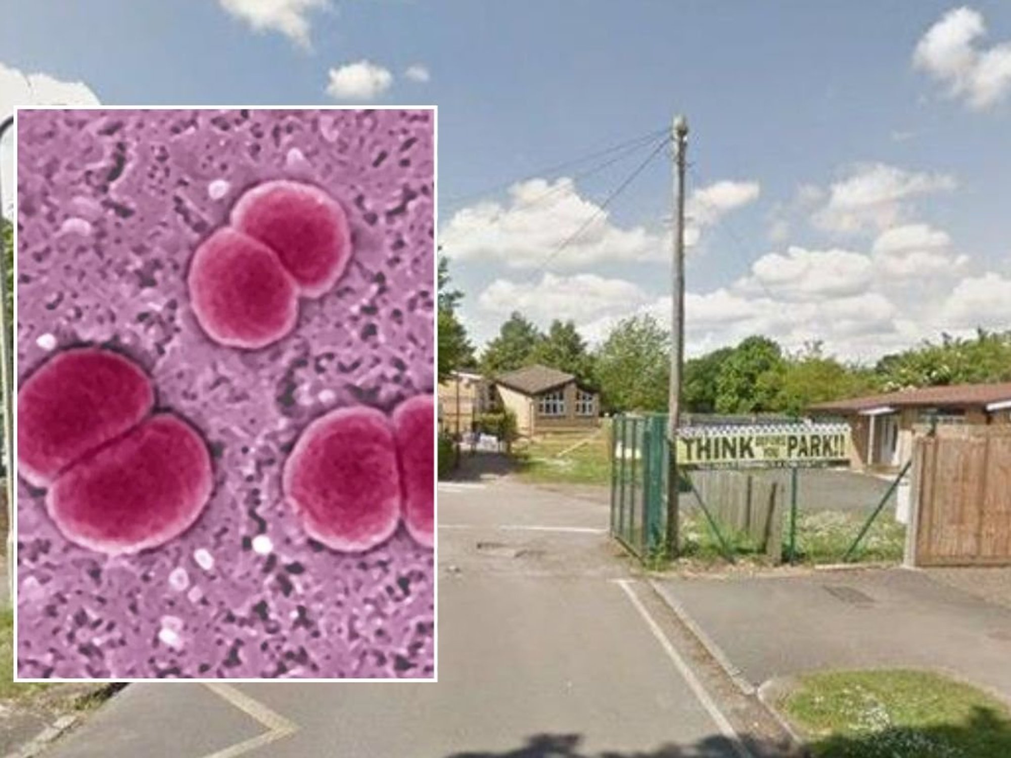 MENINGITIS