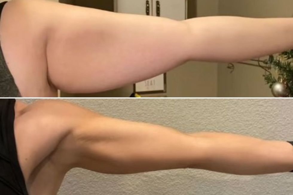 Mer arms before and after