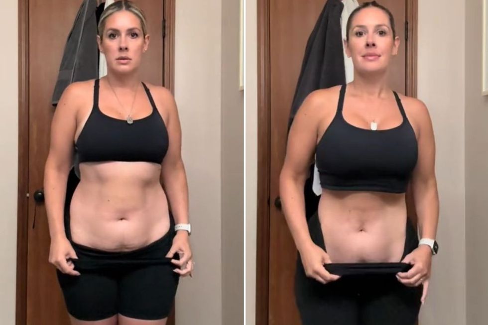 MICHELLE BEFORE AND AFTER