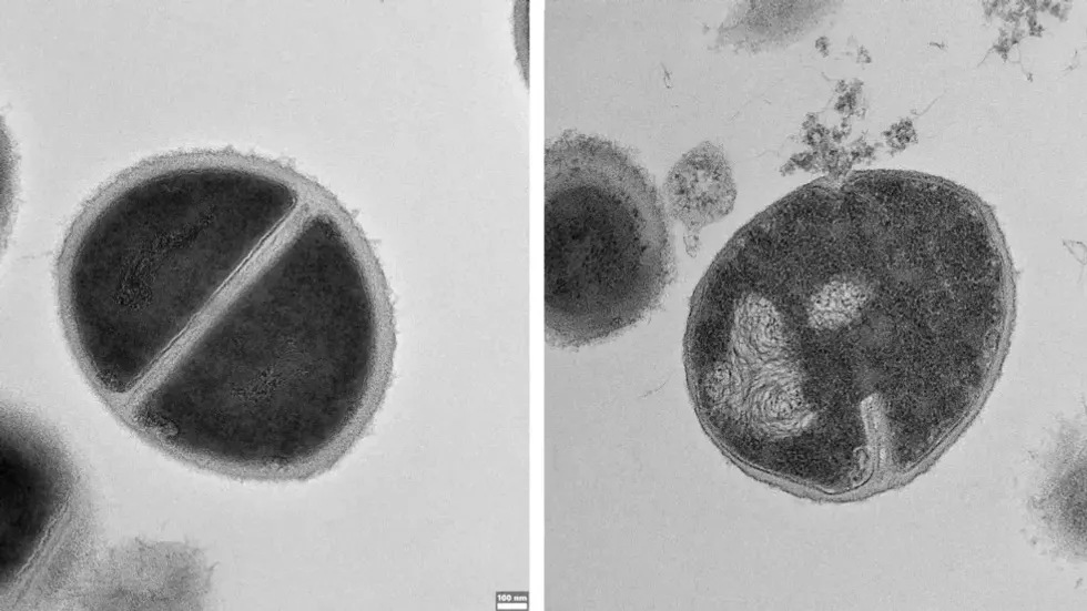 Microscope image of Staphylococcus bacteria