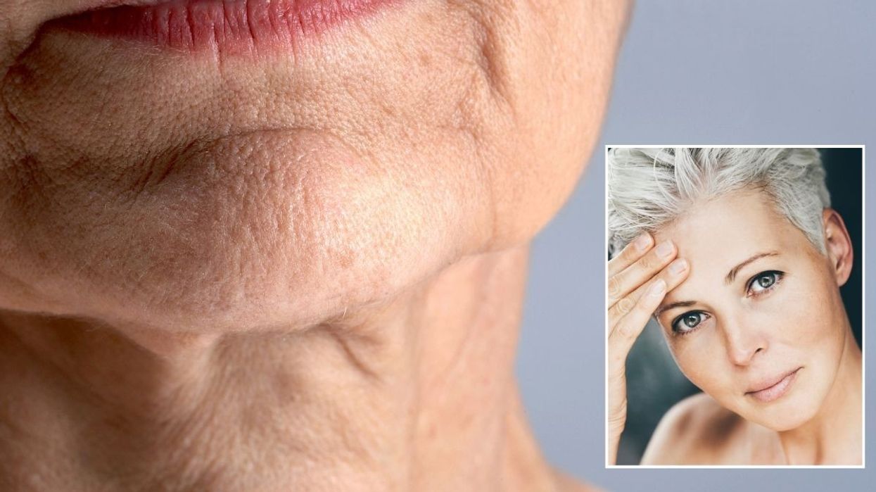 Middle-aged woman with slightly sagging skin / Middle-aged woman with firmer skin